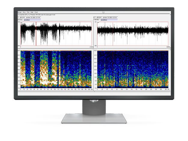 EEG and heatmap