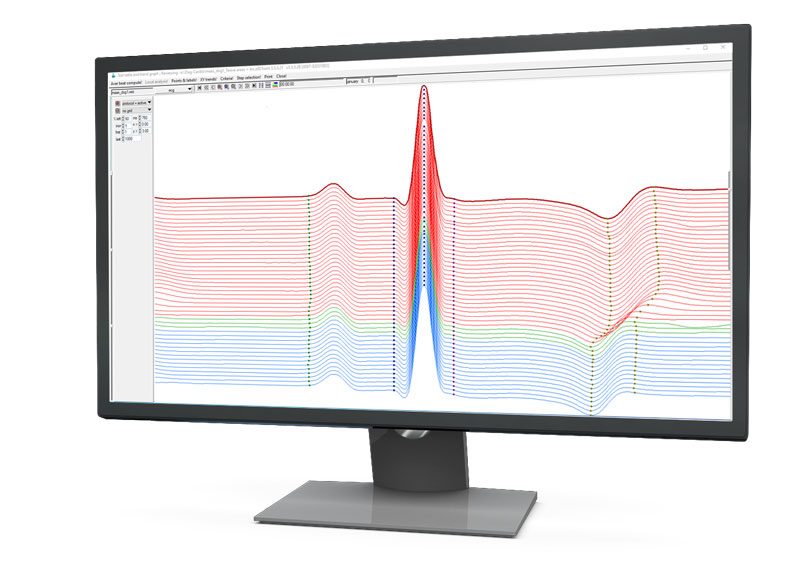 ecgAUTO software waterfall