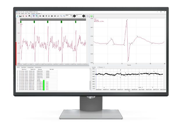 ecg average module
