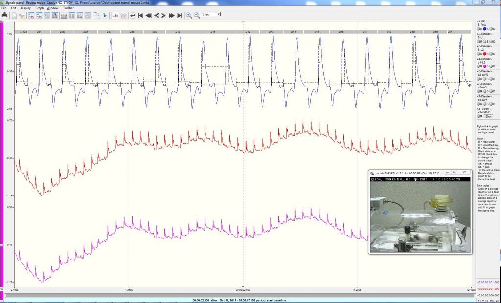 ecgTUNNEL signal