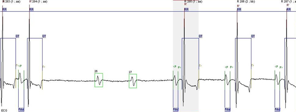 isolated-p-wave
