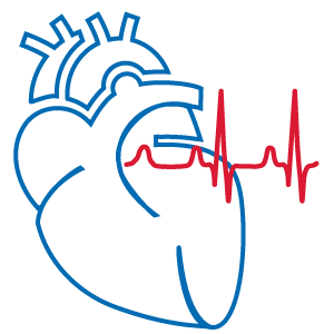 Arrhythmia
