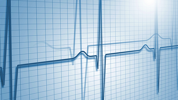 ECG signal