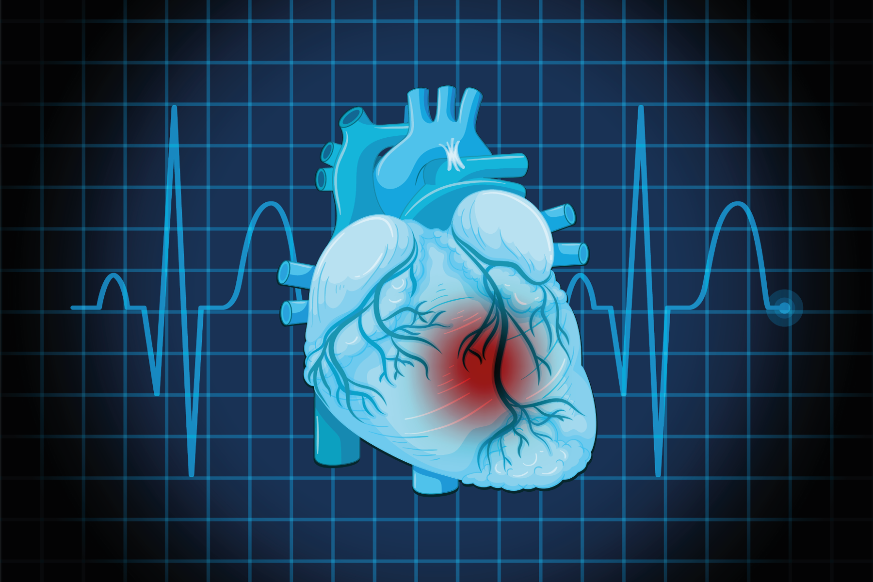 Cardiotoxicity