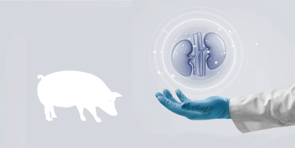 Kidney surgery