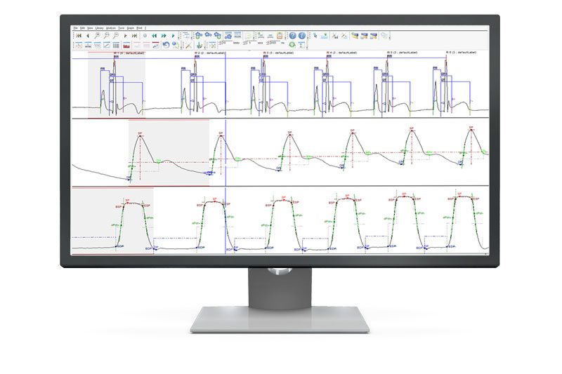 ECG-BP-LVP in ecgAUTO
